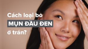 Biểu hiện mụn đầu đen trên da dầu nhạy cảm