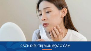 Điều Trị Mụn Bọc Ở Cằm Hiện Quả Nhanh Không Gây Thâm Mụn