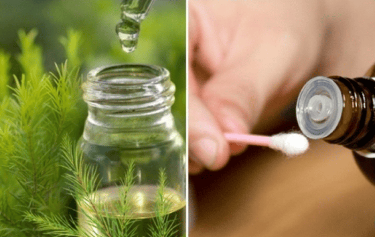 11 Lợi Ích Tinh Dầu Tràm Trà Tuyệt Vời Bạn Nên Biết